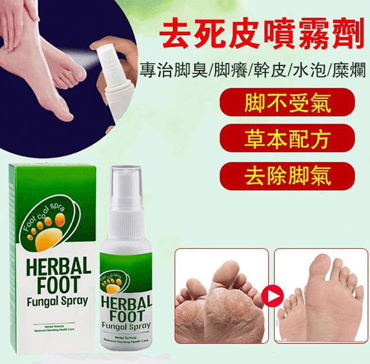 足部去角質噴霧