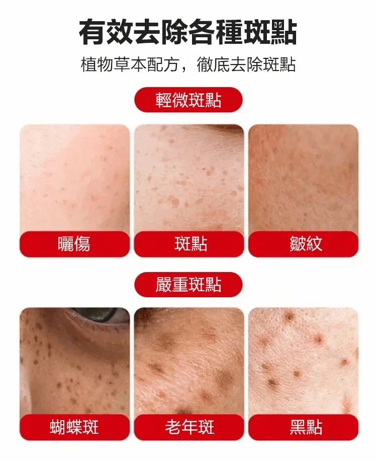 佰花方祛斑霜1706341152577214.png 佰花方祛斑霜