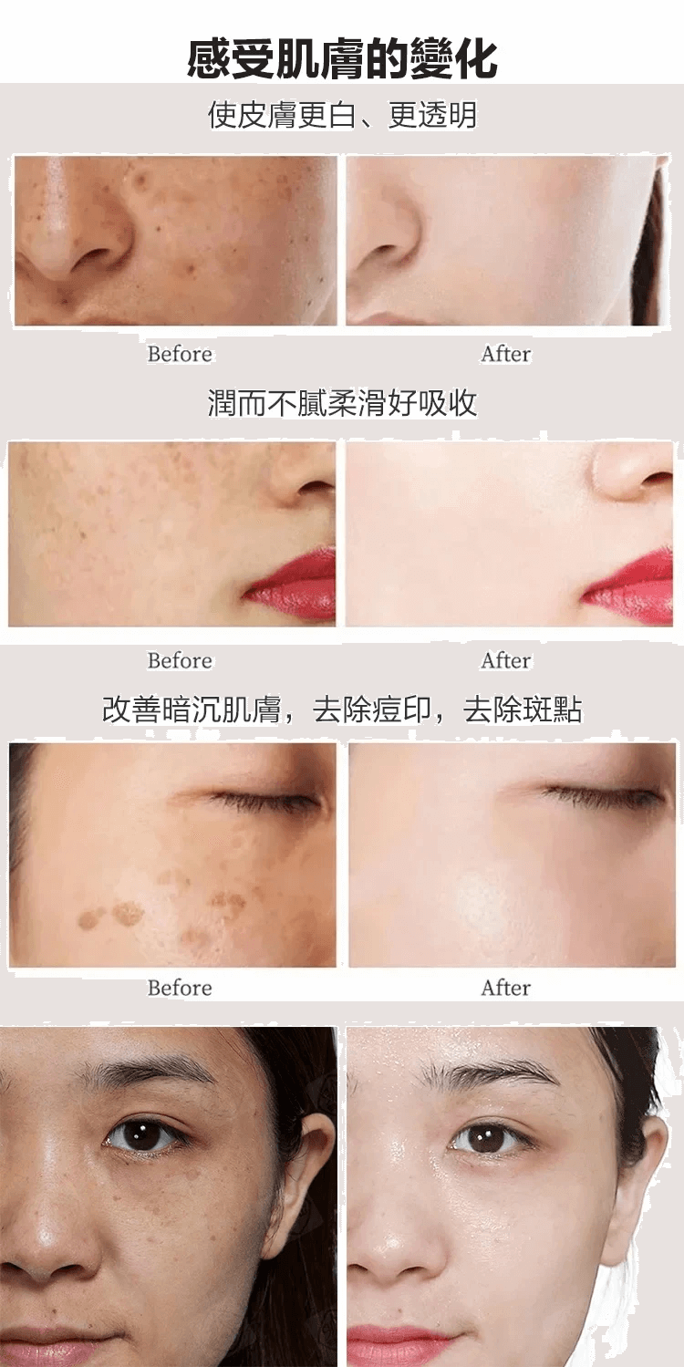 佰花方祛斑霜1706341153438062.png 佰花方祛斑霜