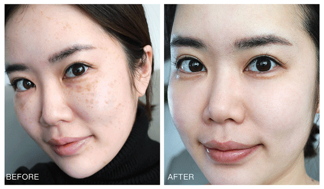 佰花方祛斑霜1706341153641577.png 佰花方祛斑霜