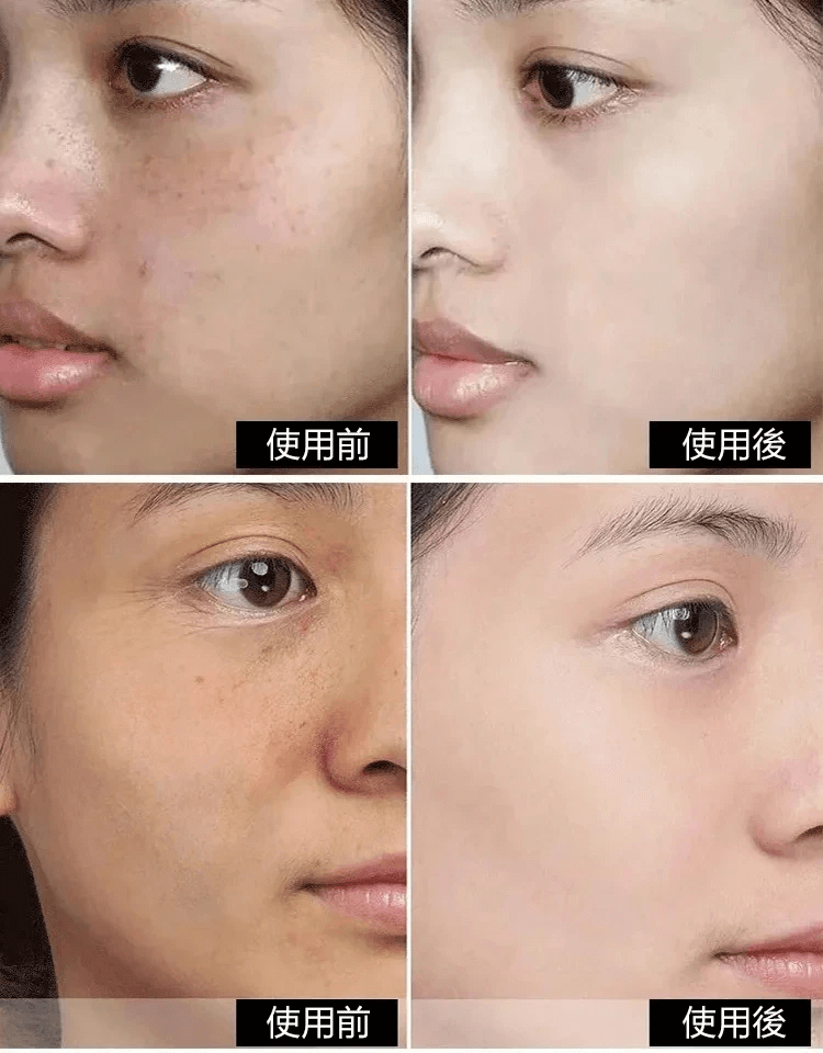 佰花方祛斑霜1706341153791935.png 佰花方祛斑霜