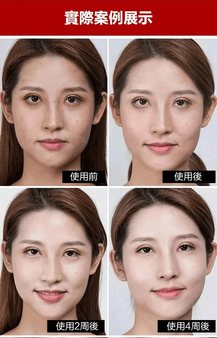 佰花方祛斑霜1706341153811614.png 佰花方祛斑霜