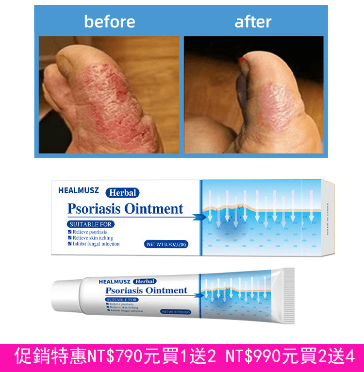 healmusz 外用皮膚膏
